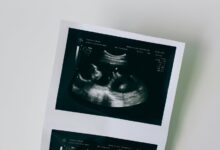 high impact development scan results