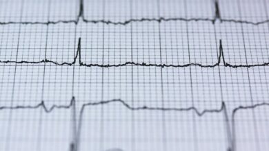 strategic excellence in motion